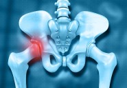 Most Adults Miss Symptoms of Hip Problems
