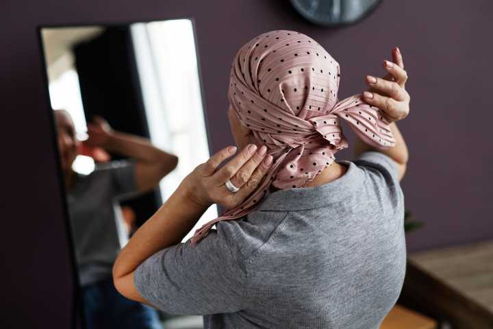 Survey: Fear of hair loss may cause cancer patients to refuse treatment