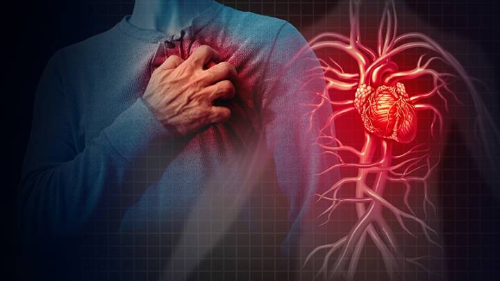 Heart Disease: Chronic Issues, Not Acute, Most Often Fatal