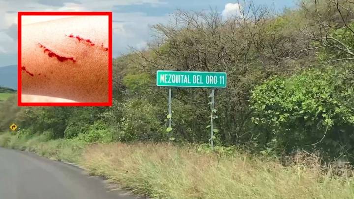 Muere adolescente infectada por rabia en Zacatecas