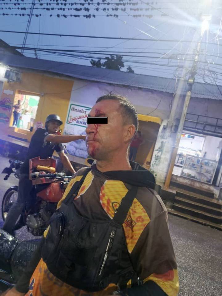 Hombre con trastorno mental ataca a transeúntes en Upata