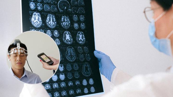 Habla por primera vez la persona que recibió implante de chip cerebral por parte de la empresa Neuralink