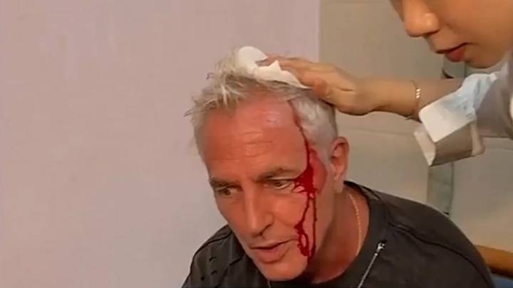 Video: el terrible accidente de Marley en Tailandia que lo dejó con la cabeza ensangrentada