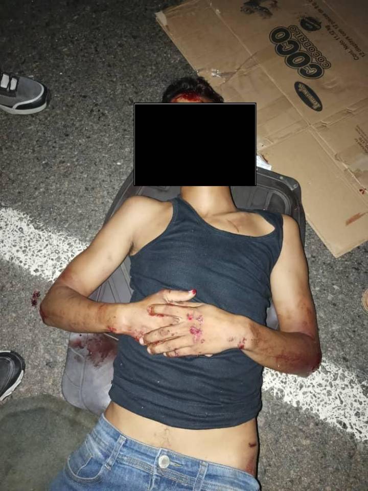 Herido grave en accidente vía Ciudad Bolívar