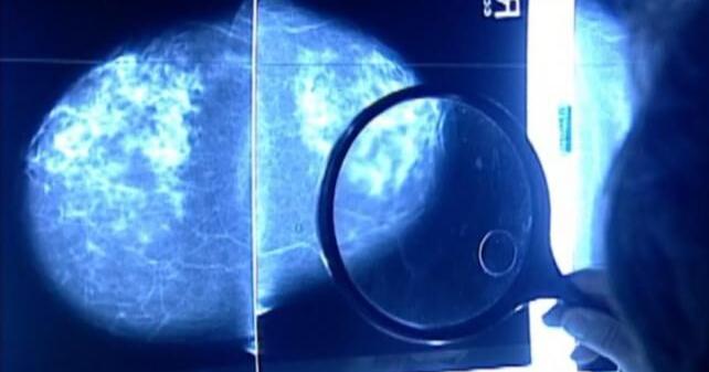 Research finds AI tools may support mental health needs of breast cancer patients