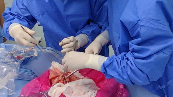 Un pulmón de cerdo "humanizado" funciona por primera vez en un paciente