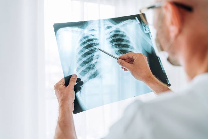 Your Diet Could Raise Lung Cancer Risk by 44%, Shocking New Research Finds