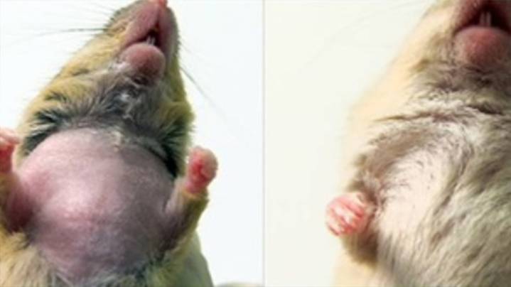Un trasplante de médula ósea detiene la progresión de la microgliopatía en ratones y humanos