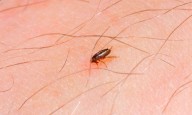 EU detecta caso de peste bubónica en California