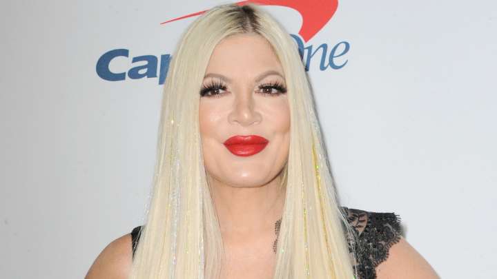 Tori Spelling's Face Has Seriously Transformed Because Of Plastic Surgery