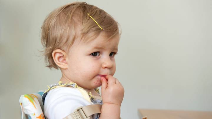 What to know about hand, foot and mouth disease and how to prevent spread