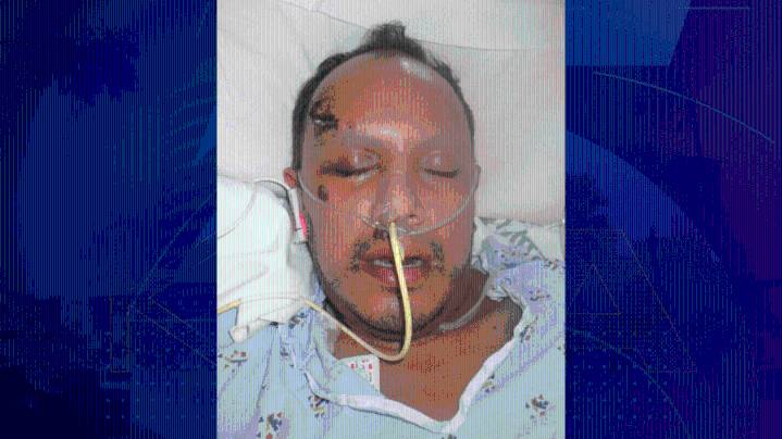 Hospital needs help identifying man found injured in downtown Los Angeles