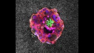 In a First, Scientists Capture Human Embryo Implantation in Real Time