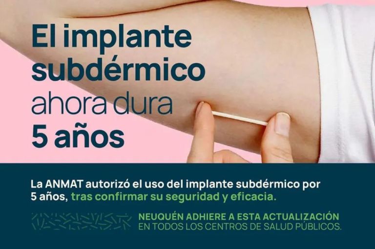 Nación certifica por cinco años la durabilidad del implante subdérmico