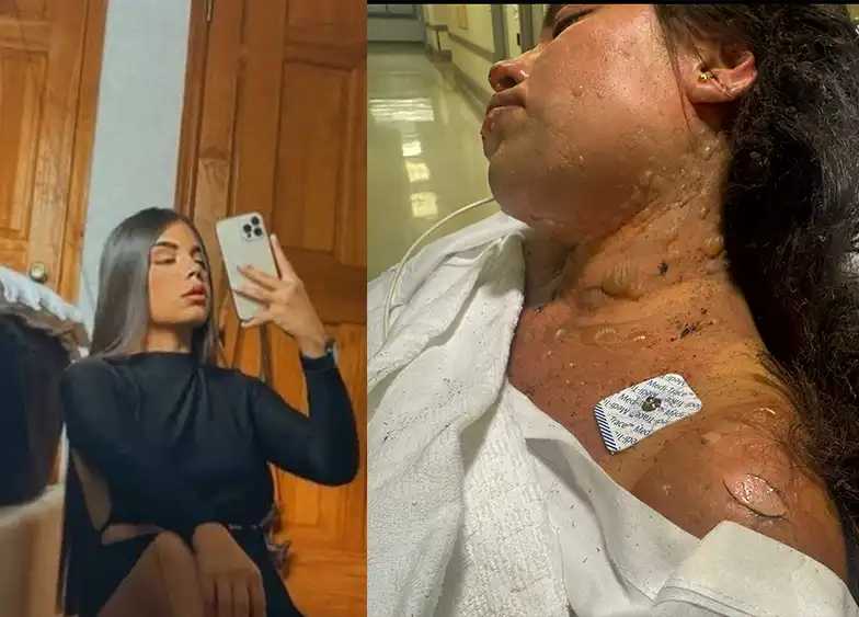 Familia de bartender colombiana pide explicaciones tras ser incendiada en un bar de Queens