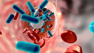 Legionnaires’ Disease Hits Hard in Harlem