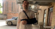 Man left with a broken arm because of the size of his penis