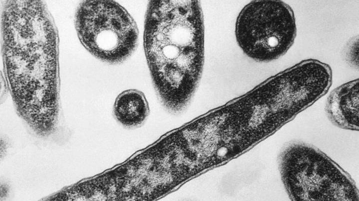 What is Legionnaires' disease? Symptoms, causes and treatment