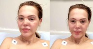 Carmen Campuzano hospitalizada tras accidente que perforó su nariz