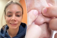 I popped a pimple in the ‘triangle of death’ and ended up in urgent care