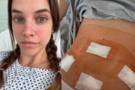 High-Profile Sports Illustrated Model Reveals Endometriosis Surgery