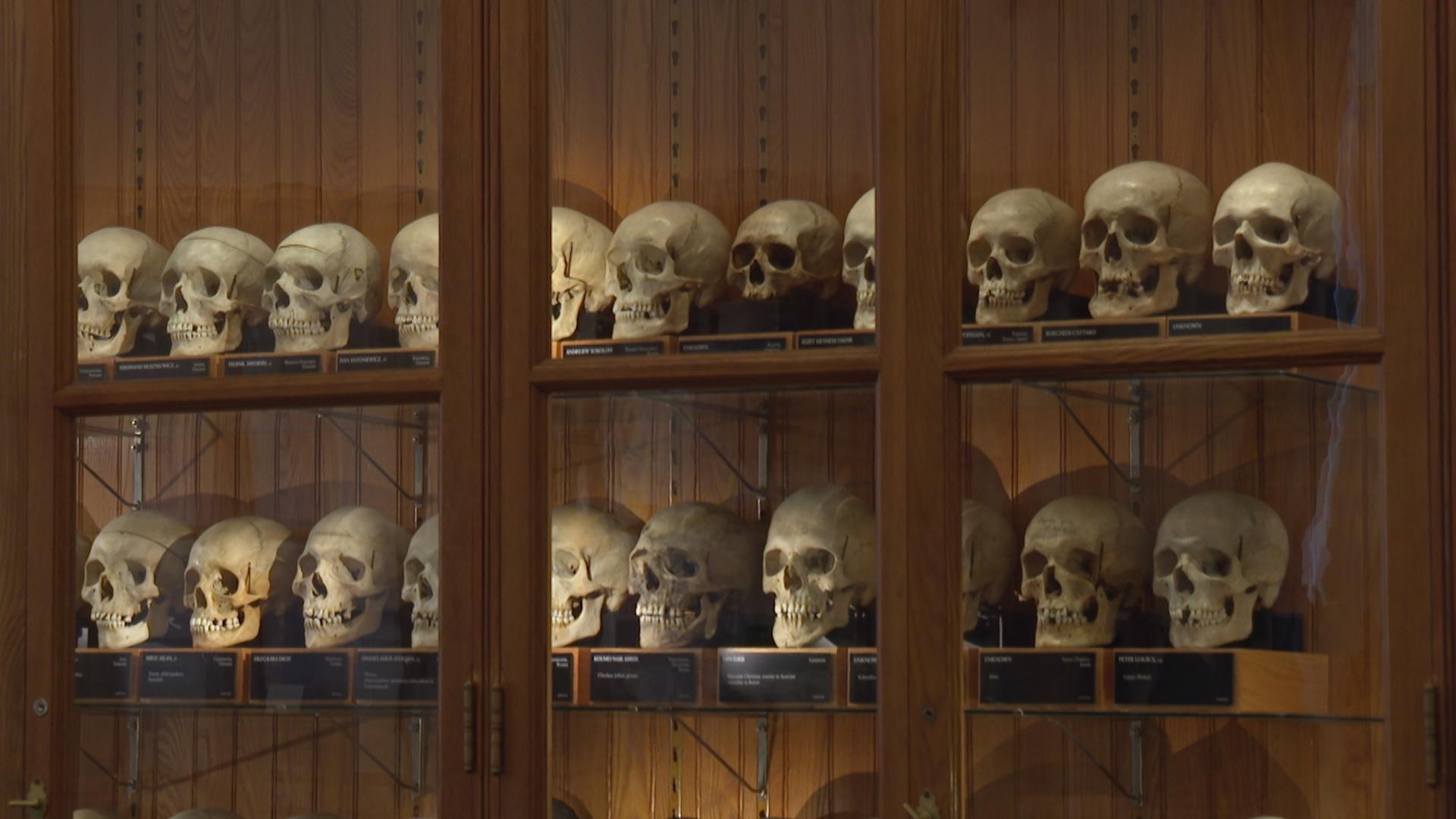 Medical museum in Philadelphia overhauls policies on human remains to meet modern ethical standards