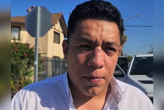 Detienen al agresor principal de Jorge Heras; policía le pagó 5 mil pesos