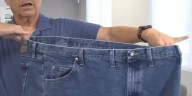 Clark County educators get bariatric surgery paid for, if they keep the weight off