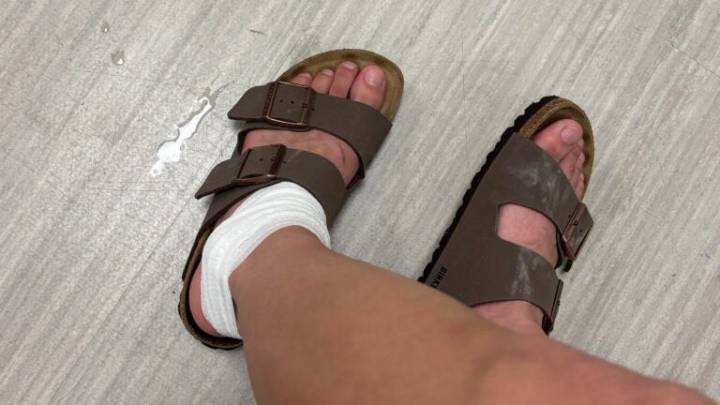 Woman says bunny-sized rat bit her foot in the Fenway