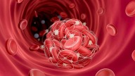 Do Women With Acute ACS Face Unnecessary Bleeding Risk?