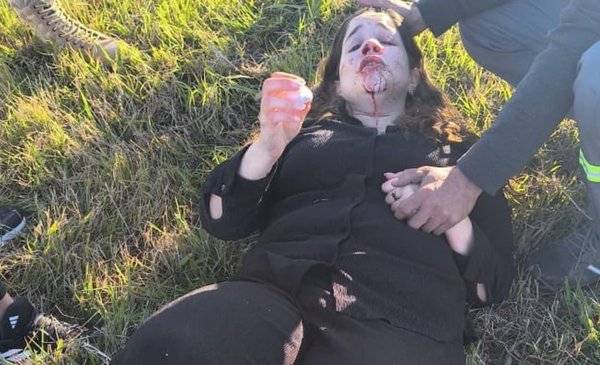 Una diputada libertaria sufrió heridas tras un despiste en la autopista Buenos Aires