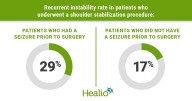Shoulder stabilization failure high in patients with seizures