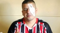 Represión en el Congreso: indagarán al prefecto acusado de dispararle al hincha que perdió la visión
