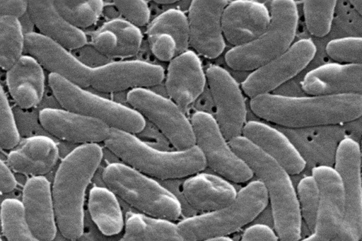 How to protect yourself from Vibrio vulnificus, the bacteria found in some coastal waters