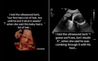 Baby Seen 'Combing' Hair On Ultrasound—Shock At What It Looks Like Now