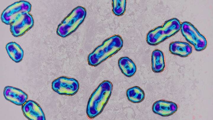 California resident tests positive for plague