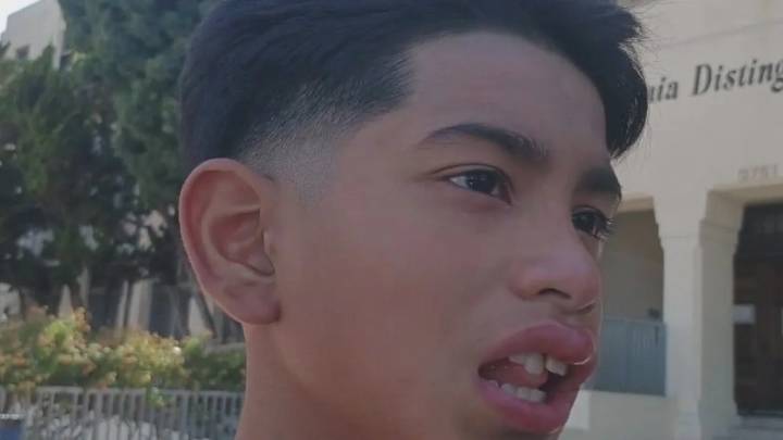 LA Teen supuestamente golpeada por compañero de clase con nudillos de latón mientras la hermana de Bully observaba