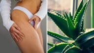 El preparado natural con aloe vera para reducir las estrías en todo el cuerpo