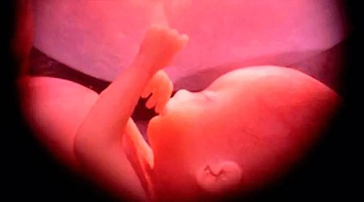 Where does your state stand on abortion?