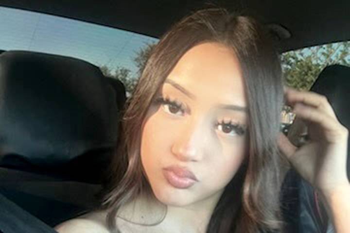 Girl, 17, Mauled by ‘Pack of Dogs’ While Jogging in California