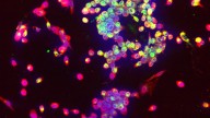 Mayo Clinic researchers discover the immune system’s ‘fountain of youth’