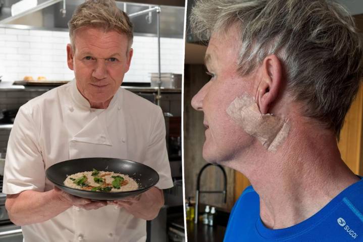 Gordon Ramsay reveals skin cancer diagnosis