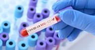 Covid cases climb to highest level this year with thousands testing positive