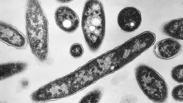 NYC Legionnaires' disease outbreak: What to know