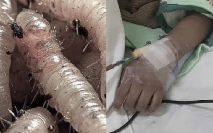 Niña en Ocosingo lucha contra el gusano barrenador, historia causa alarma