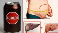Cuidado. Éstas son las partes del cuerpo en donde se acumula el azúcar que contiene el refresc...