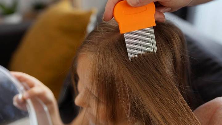Adiós a los piojos: el truco casero que solo usa dos ingredientes para eliminarlos