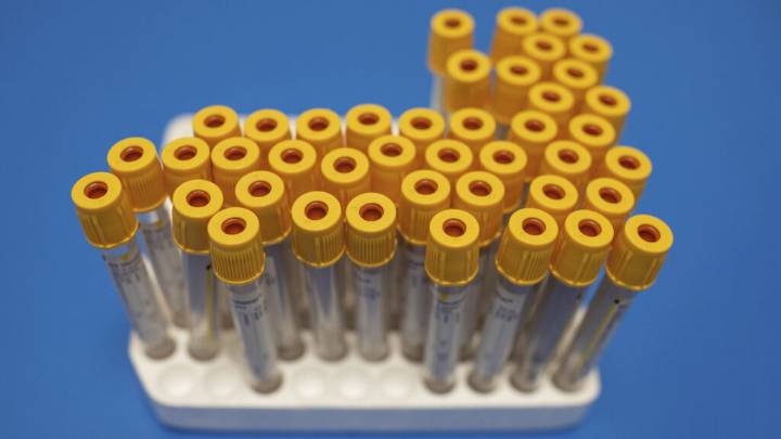 Exact Sciences acquires Freenome colon cancer liquid biopsy