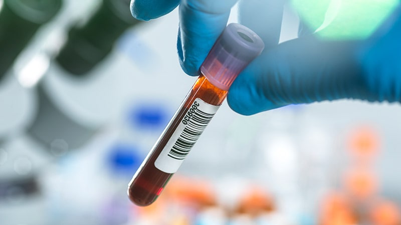 Very Abnormal Results Rare in DMARD Toxicity Monitoring