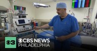 New heart surgery technique helps patients recover faster without need of painkillers